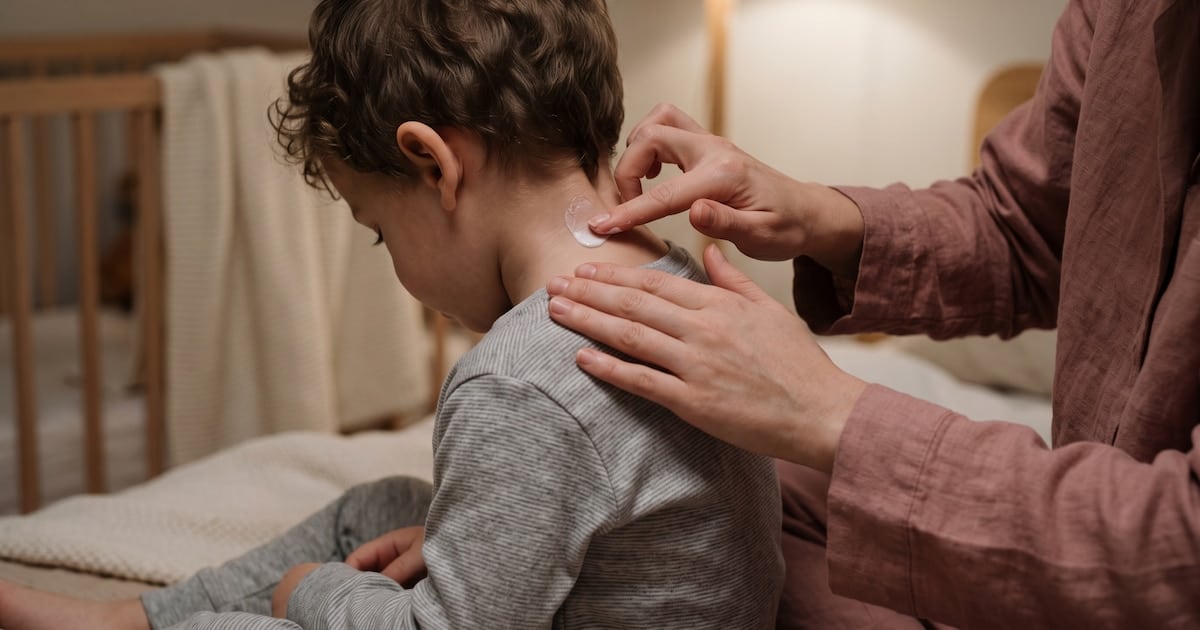 Dermatitis atópica en Argentina: cuando el bolsillo decide si la picazón sigue o se va