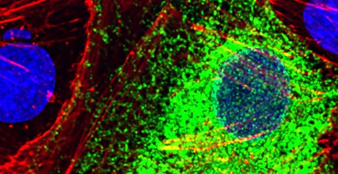 Una herramienta de inteligencia artificial distingue células sanas y enfermas a partir de sus genes activos