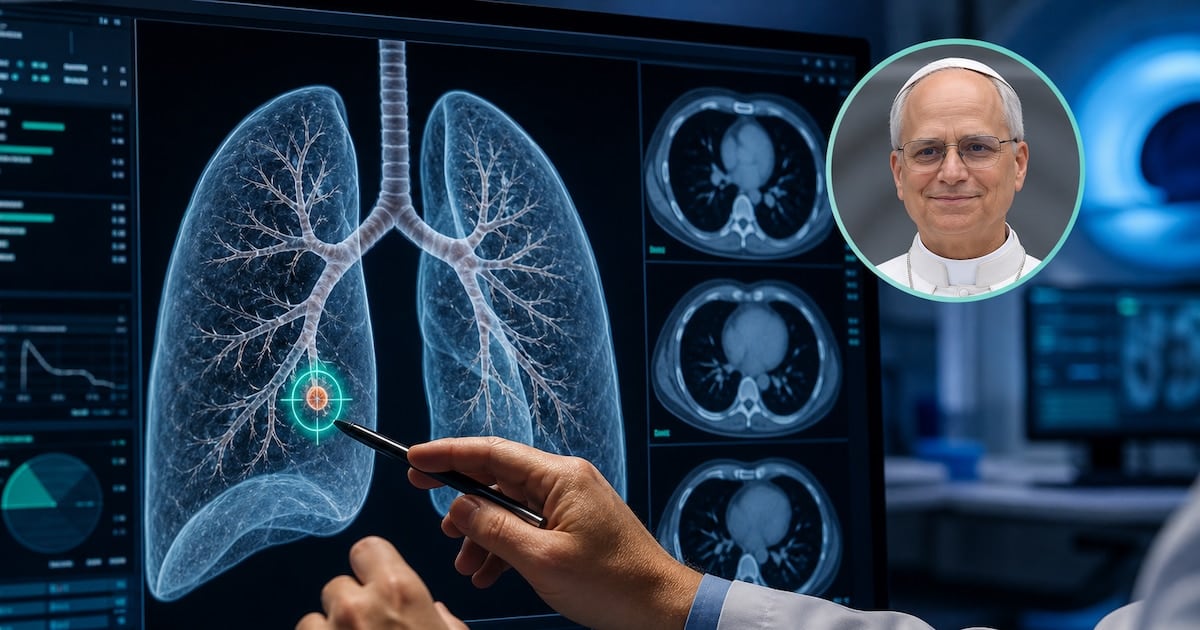 Nódulo pulmonar: por qué una mancha de tres milímetros puede terminar en el quirófano